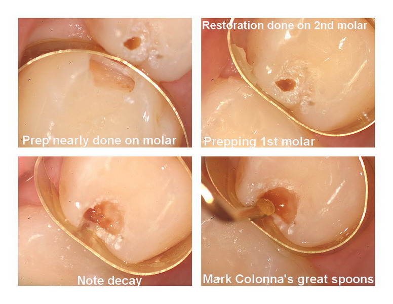 Kiss caries pg 2_resize.jpg